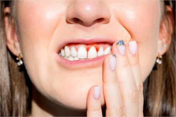  Grand Prairie Periodontal Gum Disease